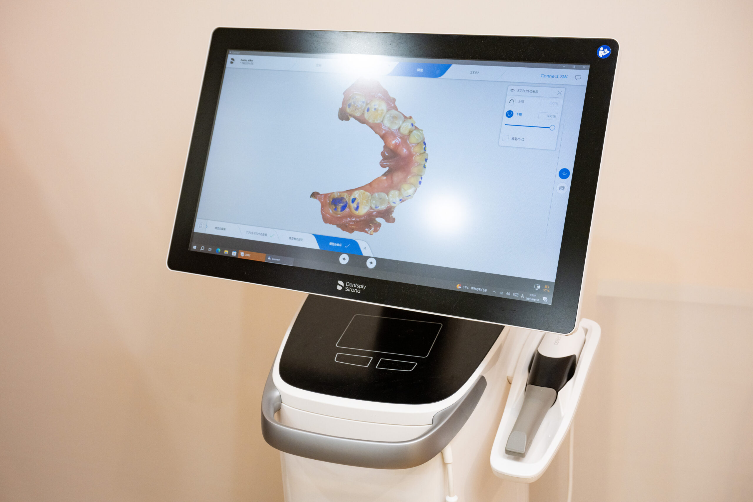 口腔内スキャナ